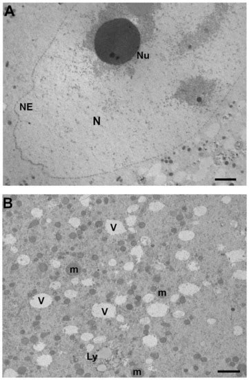 Cells | Special Issue : Molecular and Clinical Advances in ... 