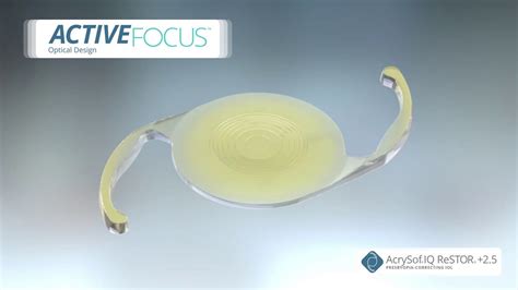 Alcon Activefocus Restor 25 Multifocal Intraocular Lens Youtube