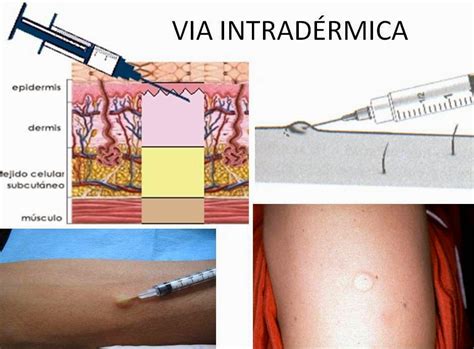 São Medicamentos Incompatíveis A Via Subcutânea