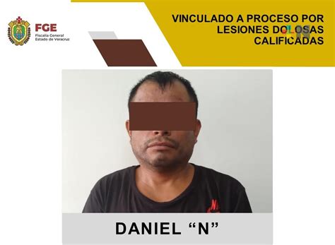 Vinculado A Proceso Por Lesiones Dolosas Calificadas MÁsnoticias