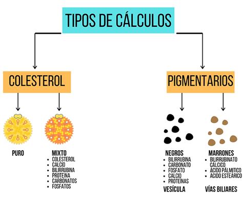 vacío precedente Doctrina que son calculos biliares página Diez Minero