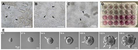 The D Culturing Of Organoids From Murine Intestinal Crypts And A