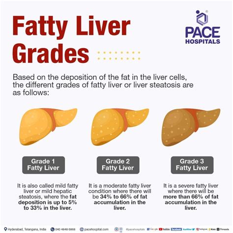 Fatty Liver Symptoms Grade Causes Complications Prevention