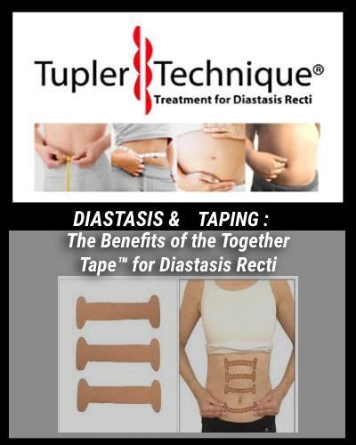 The Benefits Of The Together Tape™ For Diastasis Recti Diastasis