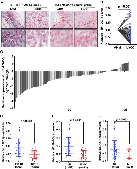 Figure 1 From MiR 1207 5p Suppresses Laryngeal Squamous Cell Carcinoma