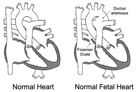 Transition From Fetal To Neonatal Circulation Flashcards Quizlet