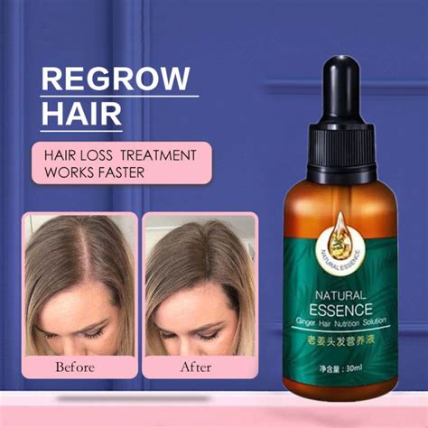 Hair Growth Spray Serum Anti Hair Loss Products Fast Grow Prevent Hair