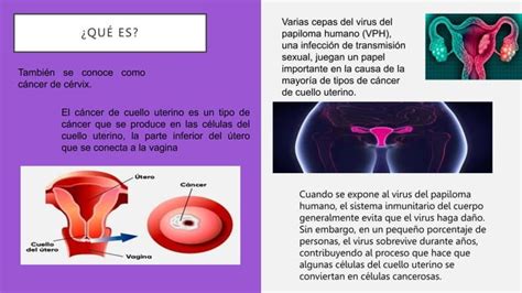 Cáncer Cervicouterinopptx