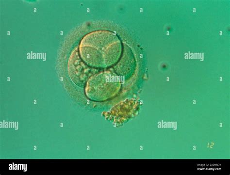 Human Embryo Light Micrograph Of An Early Human Embryo At The 4 Cell