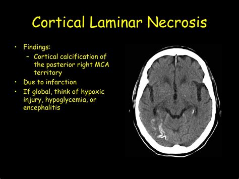 Ppt Anoxic Brain Injury Powerpoint Presentation Free Download Id 9709070