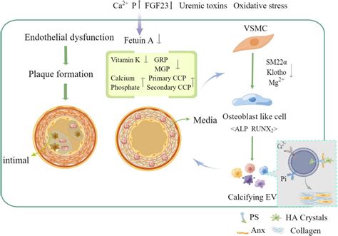 Mechanism Of Vascular Calcification Formation And Related Influencing