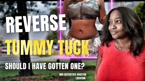 Should I Have Gotten A Reverse Tummy Tuck Youtube