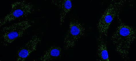 Longitudinal Natural History Study of Patients With Peroxisome ... 