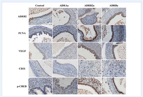 Representative Microphotographs Showing Immunohistochemical Staining Of