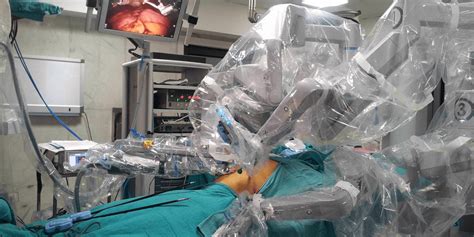 Laparoscopic Robotic Nissen Fundoplication For Gerd What You Need