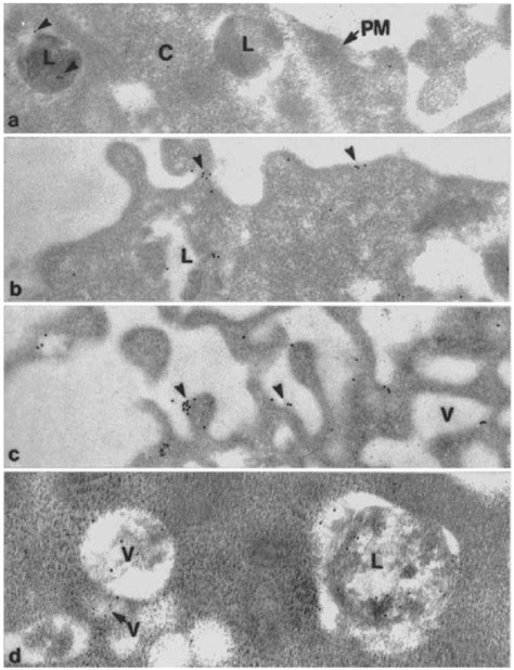 Electron Micrograph Of Normal Fibroblasts Transfected With Pcmv A