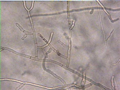 Rhizoctonia root rot/ belly rot