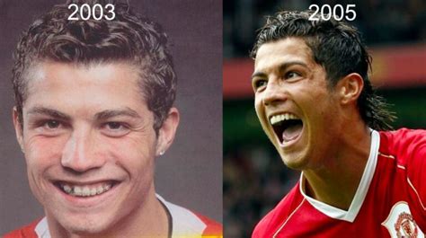 Cristiano Ronaldo And Chirurgie Esthétique Lincroyable Transformation