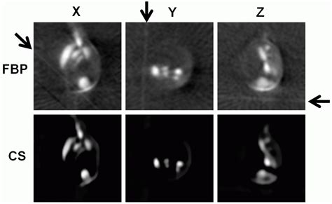 Compressed Sensing Of Spatial Electron Paramagnetic Resonance Imaging