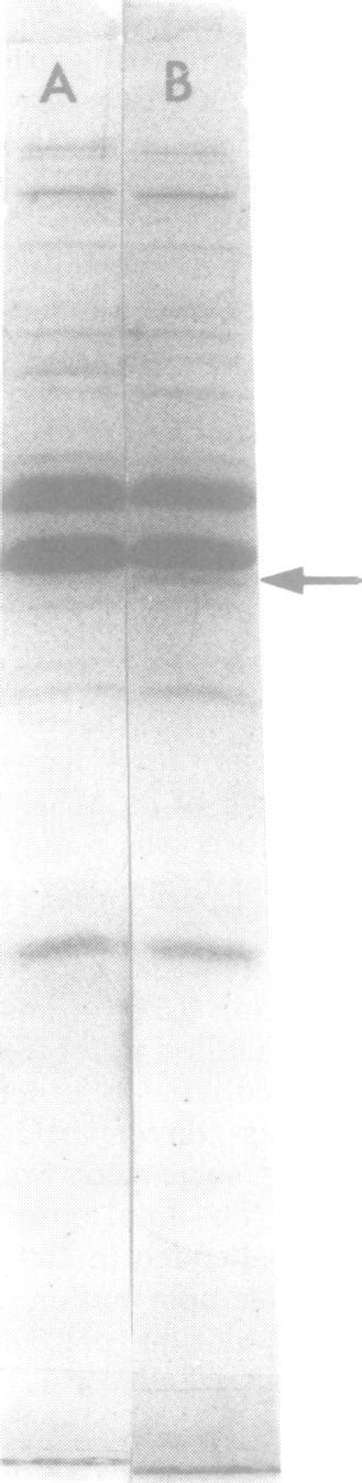 Sds Polyacrylamide Gel Electrophoresis Of The Outer Membranes Of Two Download Scientific