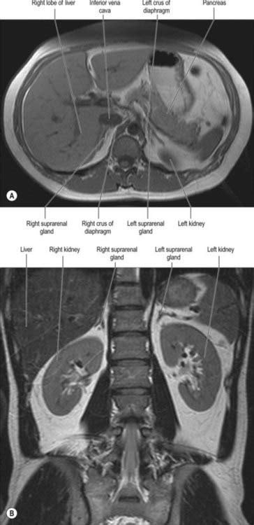 Suprarenal (adrenal) gland | Clinical Gate