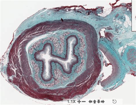 Lab 5.2: GI Histology Flashcards | Quizlet