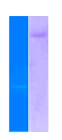 Zymogram Showing Proteolytic 1 And Amylolytic 2 Activities Of B