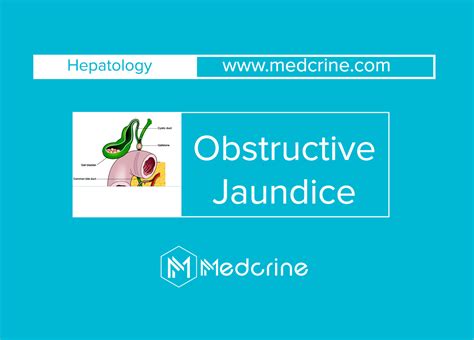 Obstructive Jaundice Causes Symptoms And Treatment Medcrine