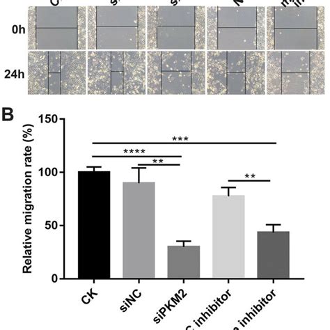 Inhibiting Mir 122 5p Promotes Pkm2 Nuclear Translocation In 786 O