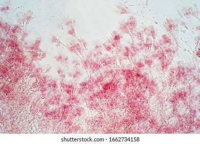 Penicillium Under Microscope: Over 193 Royalty-Free Licensable Stock ...