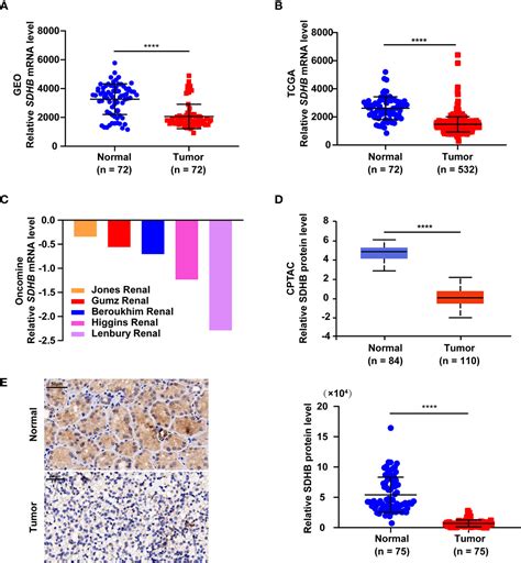 Frontiers Sdhb Suppresses The Tumorigenesis And Development Of Ccrcc By Inhibiting Glycolysis