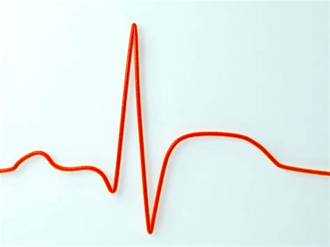 Why Is My Heart Racing? 10 Surprising Reasons | SELF
