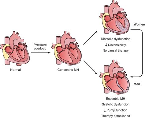 Figure From Mechanistic Pathways Of Sex Differences In Cardiovascular