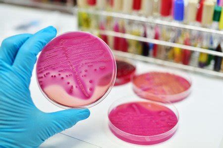 La Oms Publica La Primera Lista De Las Bacterias M S Peligrosas Para La