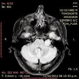 Radiologia Rmc Koda Abril