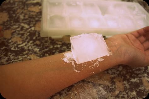 AUTOLESIÓN JUVENIL: Autolesiones ¿Que son? 