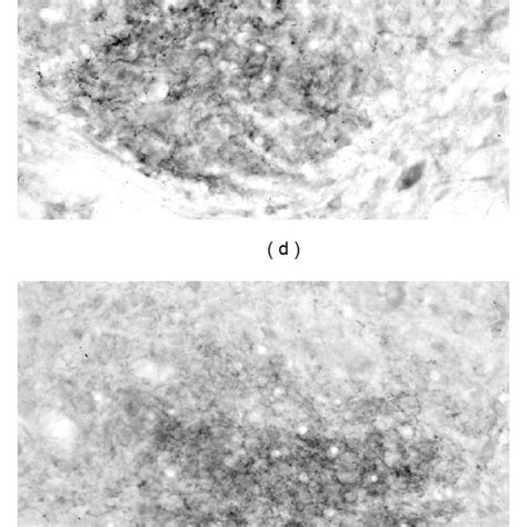 Photomicrographs Showing C Fos LI Cells In The Middle Region Of The CN