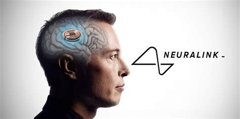 Elon Musk S Brain Implant Neuralink Receives Fda Approval For Human