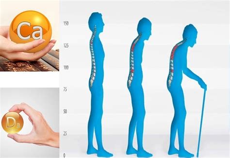 КАКВИ ЗАБОЛЯВАНИЯ МОЖЕ ДА ПРИЧИНИ ЗАГУБАТА НА КАЛЦИЙ? - Green Master