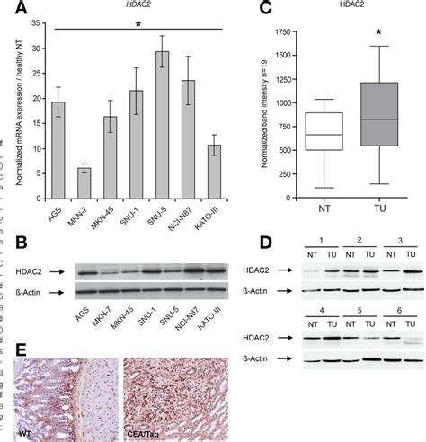 Figure From Basic And Translational Alimentary Tract Pan Histone