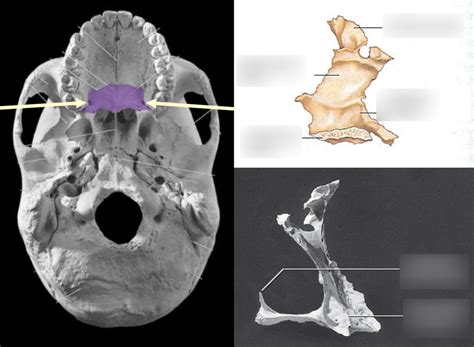 Palatine Bones Diagram | Quizlet