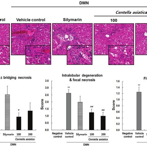 Effects Of Centella Asiatica On Dmn Induced Changes In Liver Histology