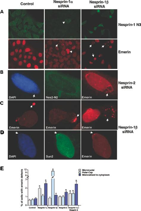 Emerin And SUN2 Are Mislocalized By Nesprin SiRNA A Emerin Defects