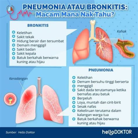 Jangkitan Pernafasan Rsv Apa Yang Dimaksudkan Dengan Kondisi Ini