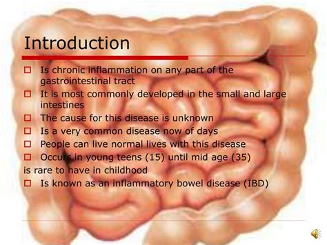 Ppt Crohn’s Disease Powerpoint Presentation Free Download Id 4954621