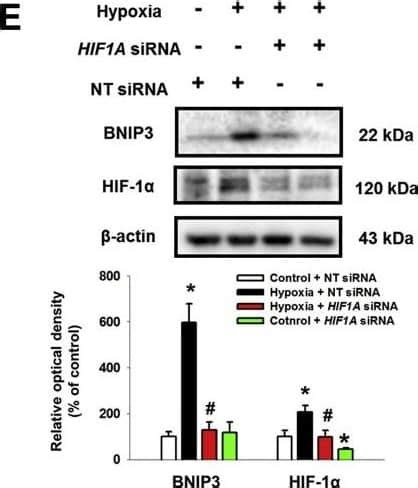 Hif Alpha Antibody H Alpha Nb Novus Biologicals