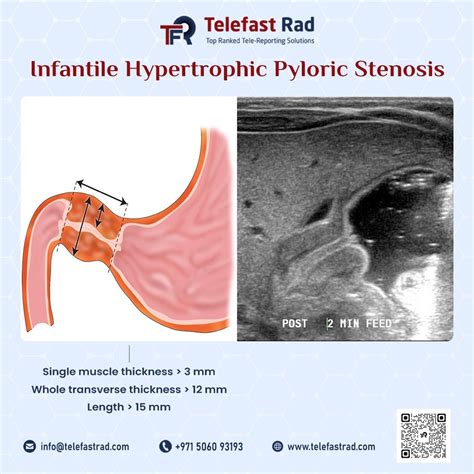 Pediatricimaging Ultrasound Teleradiology Tele Fast Rad