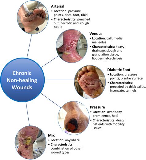 Comprehensive Care of Lower-Extremity Wounds - Surgical Clinics