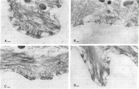 Postembedding Immunogold Electron Micrographs Of Normal Human Skin A