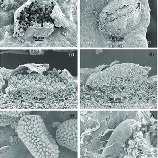 Structure morphology of the plumeria rust fungus under scanning... | Download Scientific Diagram